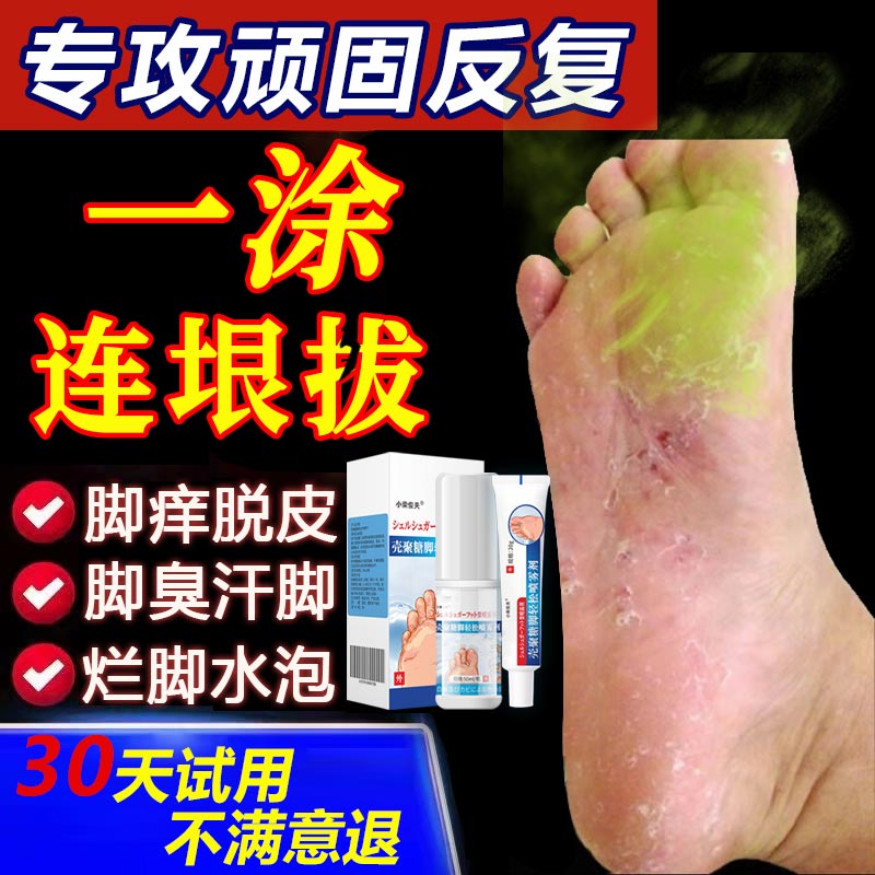 脚痒脱皮起水泡又痒又脱皮脚趾缝痒喷雾剂抑菌膏足部脚臭止痒脚底