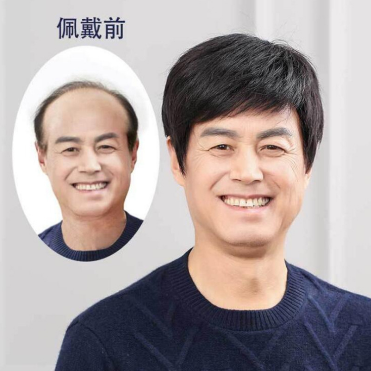 【男士三七分】中老年男士假发光头秃顶遮盖白发短直发全真人发丝