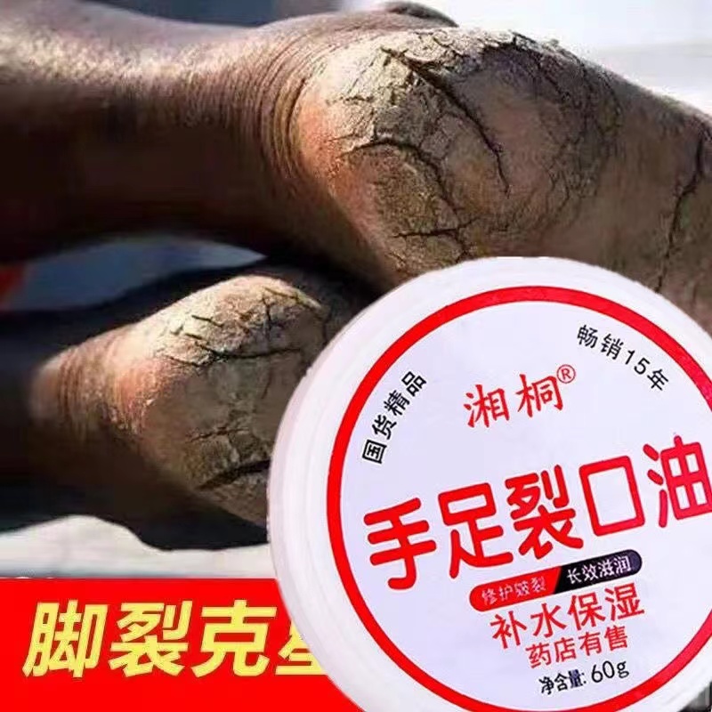 手足裂口油脚后跟干裂修复膏护手霜手足脚底干裂防裂皲裂膏护足霜