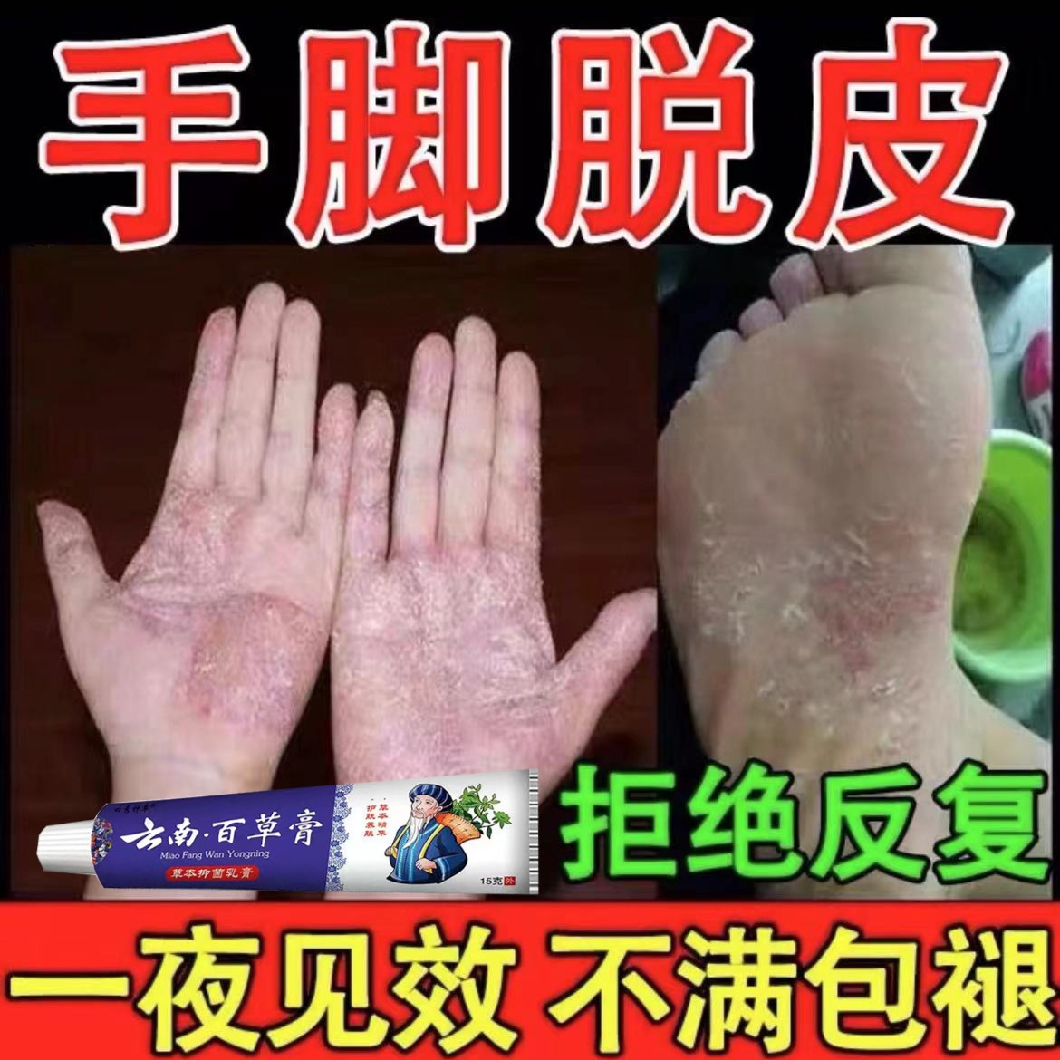 手足脱皮膏百草膏草本外用水泡干裂手部脚部脱皮专用抑菌止痒乳膏