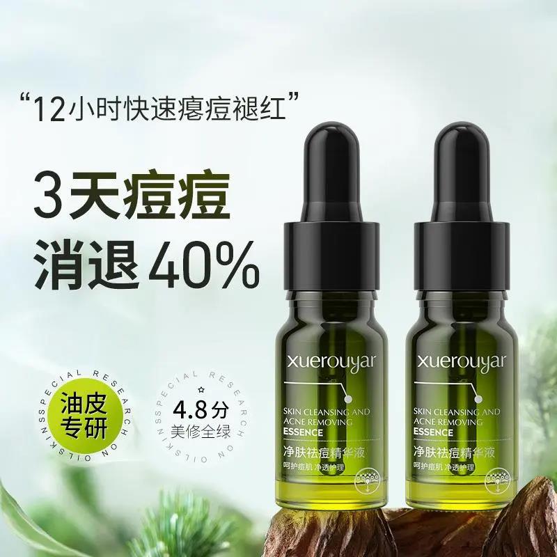 【痘痘闭口】小绿瓶!祛痘精华液净肤水杨酸去黑头闭口收缩毛孔保湿.